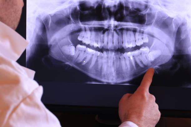 Best Knocked-Out Tooth Emergency  in New Hempstead, NY