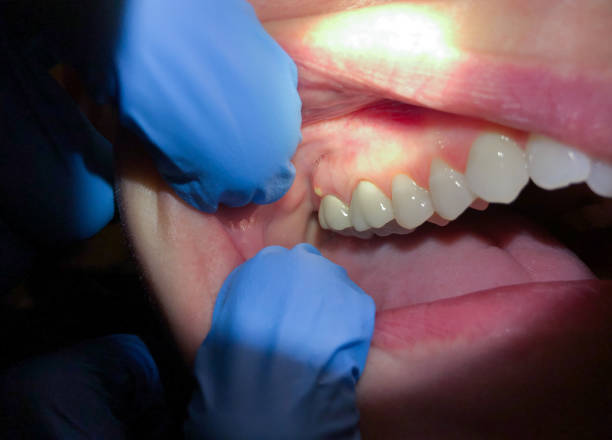 Best Emergency Gum Pain Relief  in New Hempstead, NY